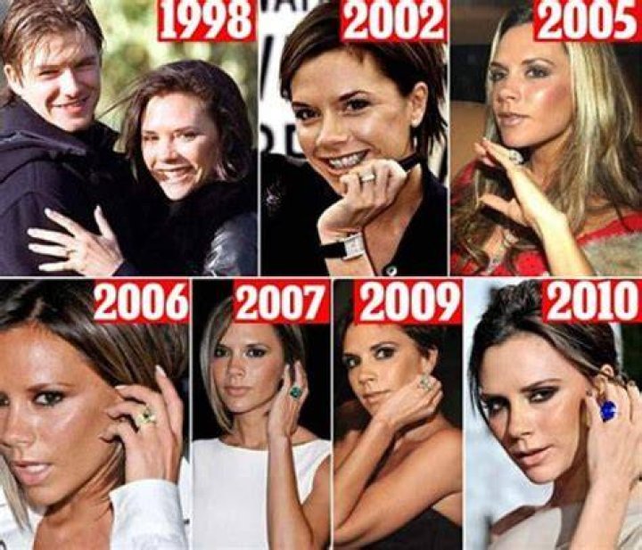 Victoria Beckham's Facelift: Unveiling the Transformation
